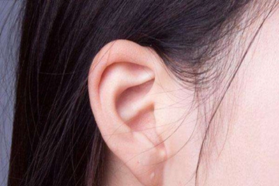 温州118医院整形科隐耳矫正 解决耳缺陷恢复自信心