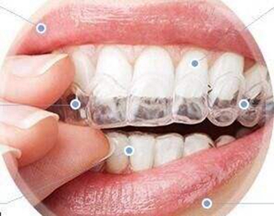 保定牙博士口腔怎么样 地包天牙齿矫正多少钱