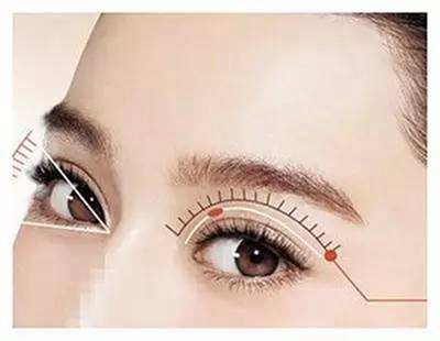 哈尔滨华美做切开双眼皮要多少钱 个性设计塑造持久双眼皮