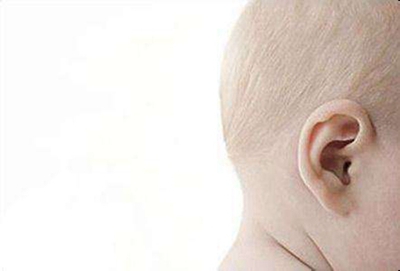 北京协和医院整形科杯状耳矫正价格是多少 会留疤吗