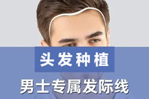 重庆做头发种植价格是多少  艺星整形医院贵吗