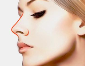 驼峰鼻矫正的方法有哪些 南昌韩美整形综合提升鼻部美感