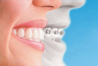 广州牙科医院哪家好 牙齿矫正价格贵吗 牙齿整齐 让你笑口常开
