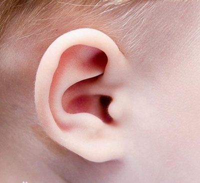 广州哪家整形医院好 小耳畸形矫正多少钱 高尚整形为您修复耳部畸形