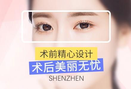 上海哪割双眼皮好 上海华侨整形医院割双眼皮费用表 360°自然美眼