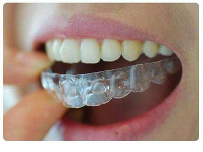 青岛牙科哪家好 牙齿矫正需要多少钱 西诺德口腔当地知名牙科诊所