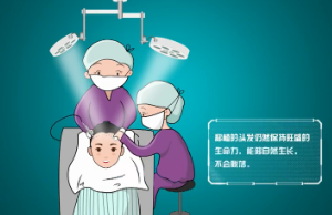 无痕植发医院 上海植信技术到位 头发种植杠杠滴