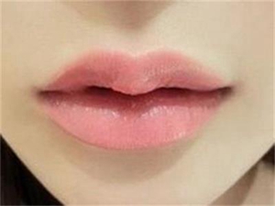 长沙厚唇整形哪家好 厚唇改薄要多少钱 艺星整形为您定制优美唇形