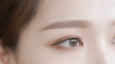 丽水美莱哪个医生技术好 眼部整形专家徐林海 双眼皮案例