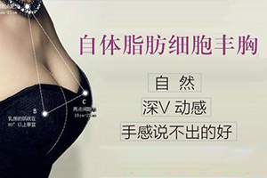 上海自体脂肪隆胸技术口碑好的医生 上海伯思立刘李娜上榜