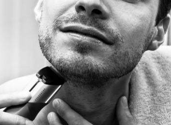 广州新发现植发医院胡须种植 让你更man更有男人味
