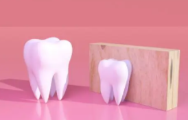 德州致雅口腔整形医院牙齿种植过程 重获自信健康牙齿