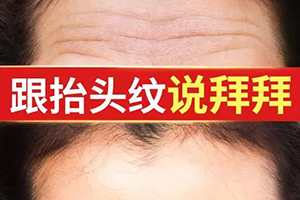 上海激光祛抬头纹 丽质医疗美容医院经验丰富 效果理想