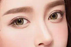 天津凤凰怡美整形医院双眼皮修复效果图 重塑灵动大眼睛